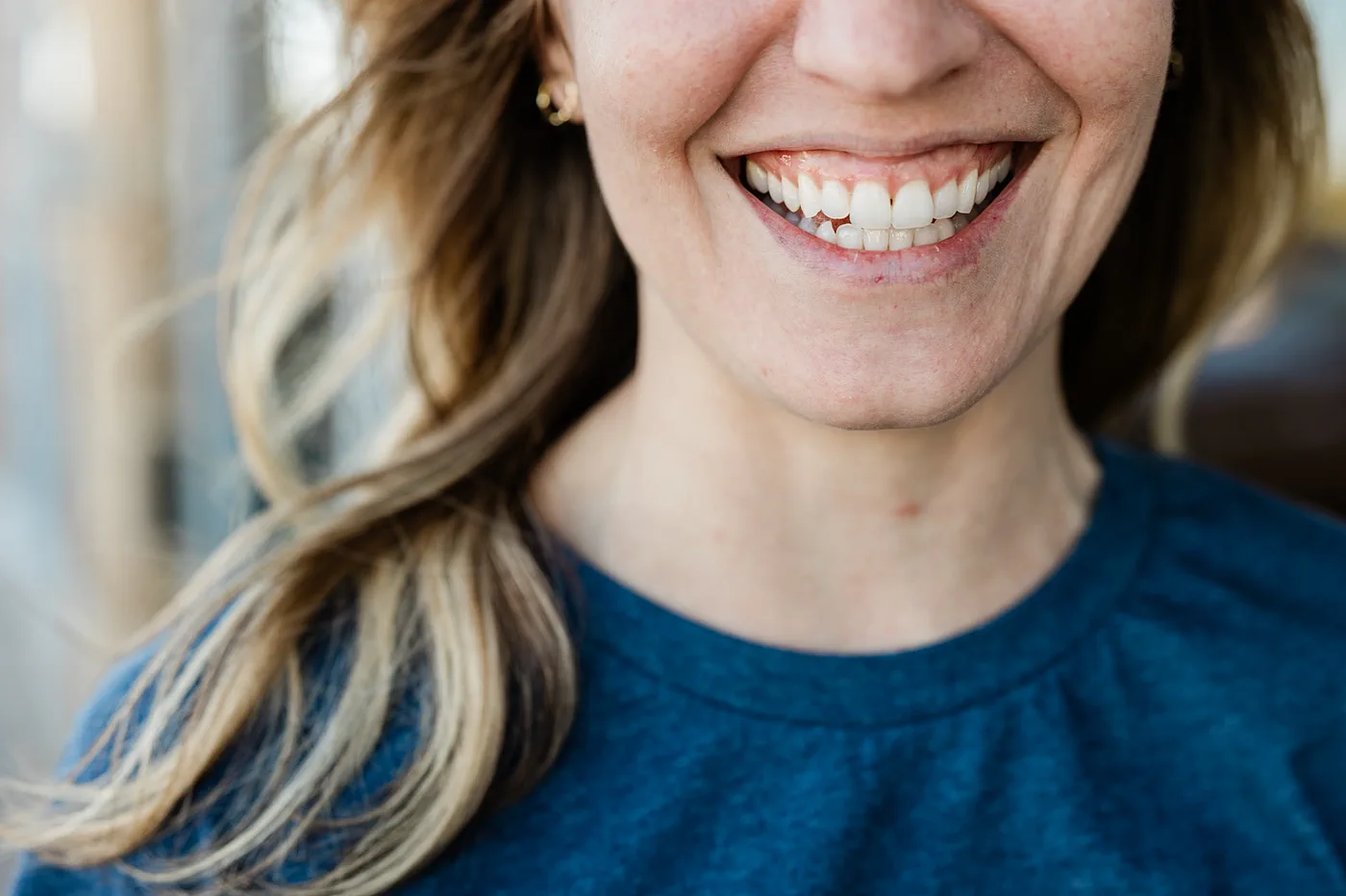 Bright close-up smile showing teeth whitening results