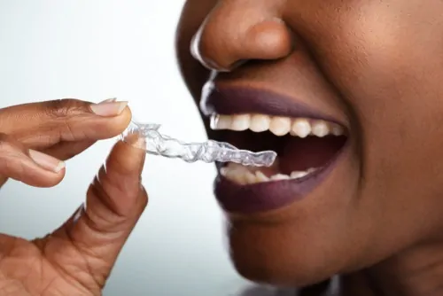 woman holds clear dental aligner